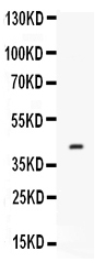 Western blot analysis of Factor D using anti-Factor D antibody (PB9850).