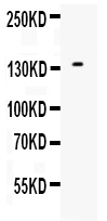 Western blot analysis of EGF using anti-EGF antibody (PB9861).