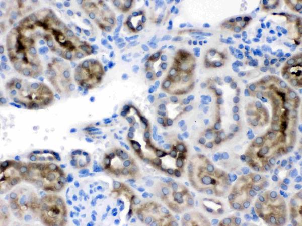 IHC analysis of CCT4 using anti-CCT4 antibody (PB9927). CCT4 was detected in paraffin-embedded section of mouse kidney tissues. Heat mediated antigen retrieval was performed in citrate buffer (pH6, epitope retrieval solution) for 20 mins. The tissue section was blocked with 10% goat serum. The tissue section was then incubated with 1μg/ml rabbit anti-CCT4 Antibody (PB9927) overnight at 4°C. Biotinylated goat anti-rabbit IgG was used as secondary antibody and incubated for 30 minutes at 37°C. The tissue section was developed using Strepavidin-Biotin-Complex (SABC)(Catalog # SA1022) with DAB as the chromogen.