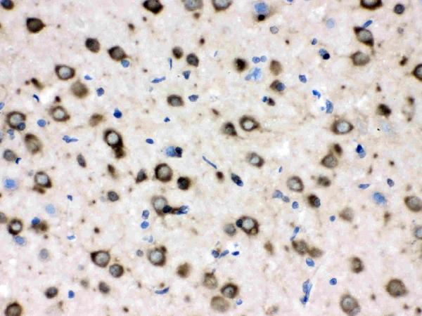 IHC analysis of CCT4 using anti-CCT4 antibody (PB9927). CCT4 was detected in paraffin-embedded section of rat kidney tissues. Heat mediated antigen retrieval was performed in citrate buffer (pH6, epitope retrieval solution) for 20 mins. The tissue section was blocked with 10% goat serum. The tissue section was then incubated with 1μg/ml rabbit anti-CCT4 Antibody (PB9927) overnight at 4°C. Biotinylated goat anti-rabbit IgG was used as secondary antibody and incubated for 30 minutes at 37°C. The tissue section was developed using Strepavidin-Biotin-Complex (SABC)(Catalog # SA1022) with DAB as the chromogen.