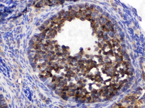 IHC analysis of CCT5 using anti-CCT5 antibody (PB9928). CCT5 was detected in paraffin-embedded section of mouse ovary tissues. Heat mediated antigen retrieval was performed in citrate buffer (pH6, epitope retrieval solution) for 20 mins. The tissue section was blocked with 10% goat serum. The tissue section was then incubated with 1μg/ml rabbit anti-CCT5 Antibody (PB9928) overnight at 4°C. Biotinylated goat anti-rabbit IgG was used as secondary antibody and incubated for 30 minutes at 37°C. The tissue section was developed using Strepavidin-Biotin-Complex (SABC)(Catalog # SA1022) with DAB as the chromogen.