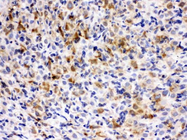 IHC analysis of CCT5 using anti-CCT5 antibody (PB9928). CCT5 was detected in paraffin-embedded section of rat ovary tissues. Heat mediated antigen retrieval was performed in citrate buffer (pH6, epitope retrieval solution) for 20 mins. The tissue section was blocked with 10% goat serum. The tissue section was then incubated with 1μg/ml rabbit anti-CCT5 Antibody (PB9928) overnight at 4°C. Biotinylated goat anti-rabbit IgG was used as secondary antibody and incubated for 30 minutes at 37°C. The tissue section was developed using Strepavidin-Biotin-Complex (SABC)(Catalog # SA1022) with DAB as the chromogen.