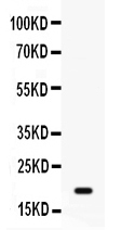 Western blot analysis of GADD45A using anti-GADD45A antibody (PB9945).
