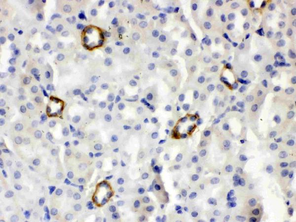 IHC analysis of ISG15/Ucrp using anti-ISG15/Ucrp antibody (PB9951). ISG15/Ucrp was detected in paraffin-embedded section of mouse kidney tissues. Heat mediated antigen retrieval was performed in citrate buffer (pH6, epitope retrieval solution) for 20 mins. The tissue section was blocked with 10% goat serum. The tissue section was then incubated with 1μg/ml rabbit anti-ISG15/Ucrp Antibody (PB9951) overnight at 4°C. Biotinylated goat anti-rabbit IgG was used as secondary antibody and incubated for 30 minutes at 37°C. The tissue section was developed using Strepavidin-Biotin-Complex (SABC)(Catalog # SA1022) with DAB as the chromogen.