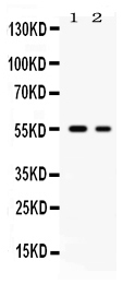 Western blot analysis of SLC2A5 using anti-SLC2A5 antibody (PB9960). Electrophoresis was performed on a 5-20% SDS-PAGE gel at 70V (Stacking gel) / 90V (Resolving gel) for 2-3 hours. The sample well of each lane was loaded with 50ug of sample under reducing conditions. Lane 1: rat brain tissue lysates, Lane 2: K562 whole cell lysates. After Electrophoresis, proteins were transferred to a Nitrocellulose membrane at 150mA for 50-90 minutes. Blocked the membrane with 5% Non-fat Milk/ TBS for 1.5 hour at RT. The membrane was incubated with rabbit anti-SLC2A5 antigen affinity purified polyclonal antibody (Catalog # PB9960) at 0.5 μg/mL overnight at 4°C, then washed with TBS-0.1%Tween 3 times with 5 minutes each and probed with a goat anti-rabbit IgG-HRP secondary antibody at a dilution of 1:10000 for 1.5 hour at RT. The signal is developed using an Enhanced Chemiluminescent detection (ECL) kit (Catalog # EK1002) with Tanon 5200 system. A specific band was detected for SLC2A5 at approximately 55KD. The expected band size for SLC2A5 is at 55KD.
