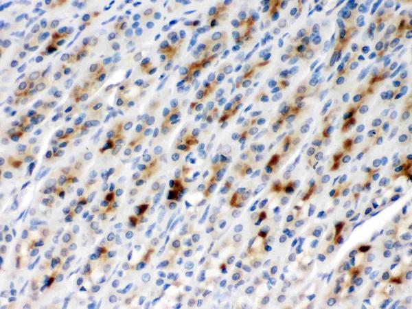 IHC analysis of CCT2 using anti-CCT2 antibody (PB9992). CCT2 was detected in paraffin-embedded section of rat gaster tissues. Heat mediated antigen retrieval was performed in citrate buffer (pH6, epitope retrieval solution) for 20 mins. The tissue section was blocked with 10% goat serum. The tissue section was then incubated with 1μg/ml rabbit anti-CCT2 Antibody (PB9992) overnight at 4°C. Biotinylated goat anti-rabbit IgG was used as secondary antibody and incubated for 30 minutes at 37°C. The tissue section was developed using Strepavidin-Biotin-Complex (SABC)(Catalog # SA1022) with DAB as the chromogen.