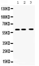 Western blot analysis of CCT8 using anti-CCT8 antibody (PB9993).