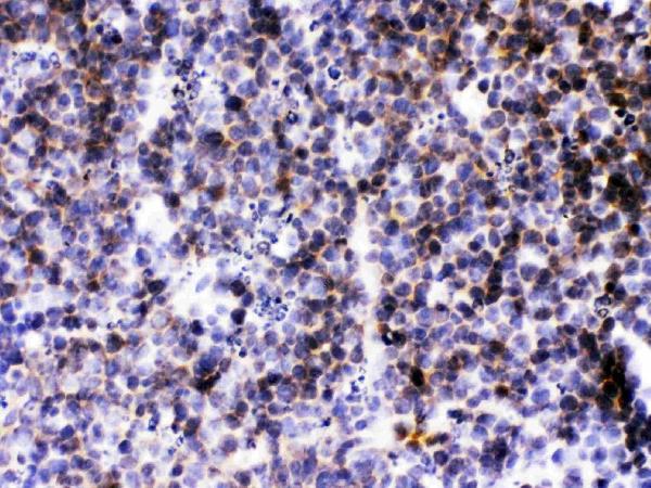 IHC analysis of CXCL13/BLC using anti-CXCL13/BLC antibody (PB9999).