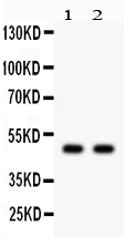 Anti-JNK2 antibody, RP1077, Western blotting All lanes: Anti JNK2 (RP1077) at 0.5ug/ml