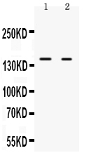 Anti-RIP140 antibody, RP1095, Western blotting All lanes: Anti RIP140 (RP1095) at 0.5ug/ml