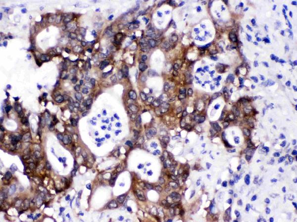 IHC analysis of CACYBP using anti-CACYBP antibody (RP1104).