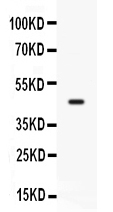 Western blot analysis of CD33 expression in mosue lung extract (lane 1). CD33 at 45KD was detected using rabbit anti-CD33 Antigen Affinity purified polyclonal antibody (Catalog # RP1105) at 0.5 μg/mL. The blot was developed using chemiluminescence (ECL) method (Catalog # EK1002).