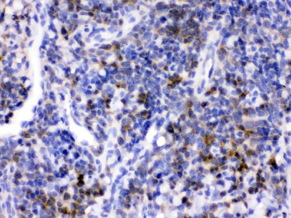 CD33 was detected in paraffin-embedded sections of mouse spleen tissues using rabbit anti-CD33 Antigen Affinity purified polyclonal antibody (Catalog # RP1105) at 1 μg/mL. The immunohistochemical section was developed using SABC method (Catalog # SA1022).