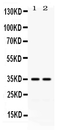 Western blot analysis of LFA3 expression in HELA whole cell lysates (lane 1) and K562 whole cell lysates (lane 2). LFA3 at 35KD was detected using rabbit anti-LFA3 Antigen Affinity purified polyclonal antibody (Catalog # RP1106) at 0.5 μg/mL. The blot was developed using chemiluminescence (ECL) method (Catalog # EK1002).