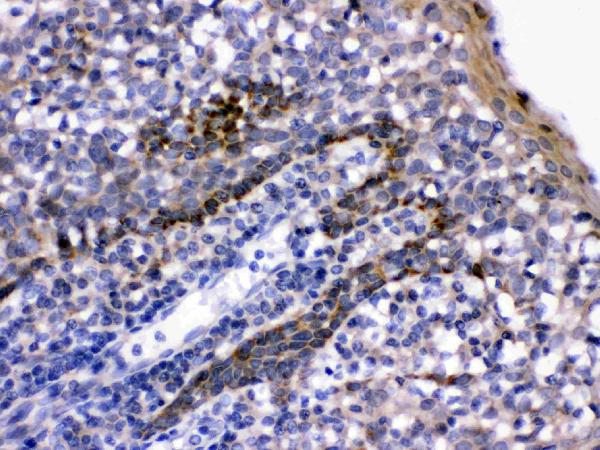 LFA3 was detected in paraffin-embedded sections of human tonsil tissues using rabbit anti-LFA3 Antigen Affinity purified polyclonal antibody (Catalog # RP1106) at 1 μg/mL. The immunohistochemical section was developed using SABC method (Catalog # SA1022).