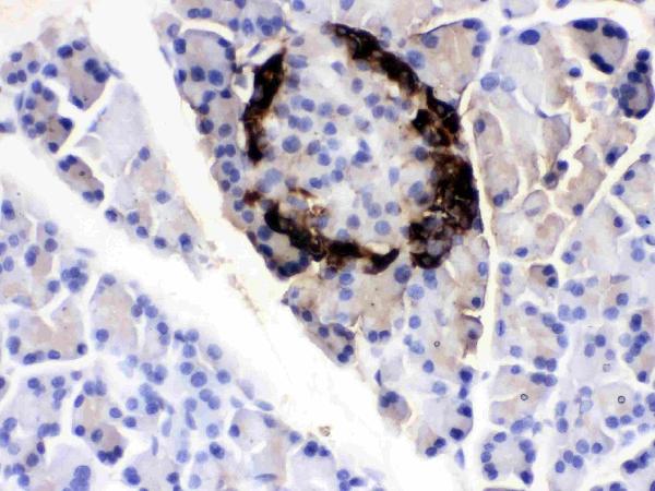 IHC analysis of VIP using anti-VIP antibody (RP1108).