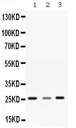 Western blot analysis of SRI expression in rat liver extract (lane 1), rat brain extract (lane 2) and SMMC7721 whole cell lysates (lane 3). SRI at 26KD was detected using rabbit anti-SRI Antigen Affinity purified polyclonal antibody (Catalog # RP1110) at 0.5 μg/mL. The blot was developed using chemiluminescence (ECL) method (Catalog # EK1002).