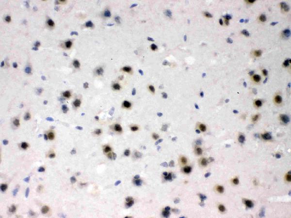 AZIN2 was detected in paraffin-embedded sections of mouse brain tissues using rabbit anti-AZIN2 Antigen Affinity purified polyclonal antibody (Catalog # RP1112) at 1 μg/mL. The immunohistochemical section was developed using SABC method (Catalog # SA1022).