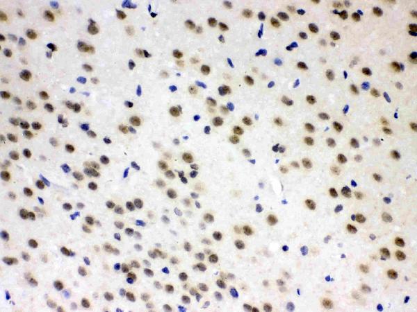 AZIN2 was detected in paraffin-embedded sections of rat brain tissues using rabbit anti-AZIN2 Antigen Affinity purified polyclonal antibody (Catalog # RP1112) at 1 μg/mL. The immunohistochemical section was developed using SABC method (Catalog # SA1022).