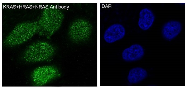 Immunofluorescent analysis of HeLa cells, using KRAS+HRAS+NRAS Antibody.