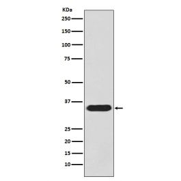 Anti Caspase 3 Pro Caspase 3 Rabbit Monoclonal Antibody M