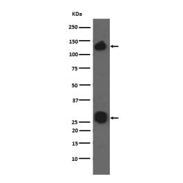 Anti Integrin Alpha V Itgav Rabbit Monoclonal Antibody M 1