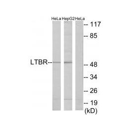 Anti Ltbr Tnfrsf3 Antibody A