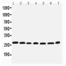 Anti Integrin Beta 4 Binding Protein Eif6 Antibody