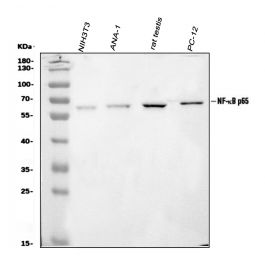 Western blots show p65 antibodies that passed the test of specificity