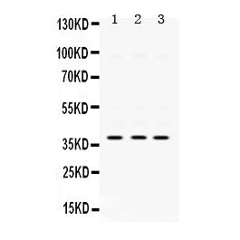 Anti Ampk Beta 1 Prkab1 Antibody Picoband Bosterbio