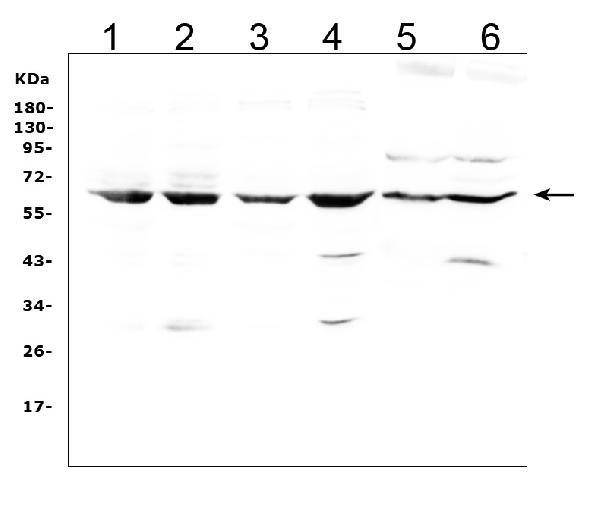 Western blot analysis of LBP using anti-LBP antibody (A00809-3). Electrophoresis was performed on a 5-20% SDS-PAGE gel at 70V (Stacking gel) / 90V (Resolving gel) for 2-3 hours. The sample well of each lane was loaded with 50ug of sample under reducing conditions. Lane 1: human Hela whole cell lysates, Lane 2: human Jurkat whole cell lysates, Lane 3: human A549 whole cell lysates, Lane 4: human Raji whole cell lysates, Lane 5: rat liver tissue lysates, Lane 6: mouse liver tissue lysates. After Electrophoresis, proteins were transferred to a Nitrocellulose membrane at 150mA for 50-90 minutes. Blocked the membrane with 5% Non-fat Milk/ TBS for 1.5 hour at RT. The membrane was incubated with rabbit anti-LBP antigen affinity purified polyclonal antibody (Catalog # A00809-3) at 0.5 μg/mL overnight at 4°C, then washed with TBS-0.1%Tween 3 times with 5 minutes each and probed with a goat anti-rabbit IgG-HRP secondary antibody at a dilution of 1:10000 for 1.5 hour at RT. The signal is developed using an Enhanced Chemiluminescent detection (ECL) kit (Catalog # EK1002) with Tanon 5200 system. A specific band was detected for LBP at approximately 65KD. The expected band size for LBP is at 53KD.