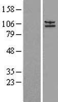 alpha Adaptin (AP2A2) Human Over-expression Lysates NM_012305. <br> Western blot validation of overexpression lysate (LS000161) using anti-DDK antibody. Left: Cell lysates from un-transfected HEK293T cells; Right: Cell lysates from HEK293T cells transfected with AP2A2 (Myc-DDK-tagged) Human Tagged ORF Clone using transfection reagent.