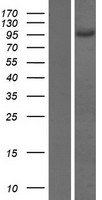 AP1B1 Human Over-expression Lysates NM_001127. <br> Western blot validation of overexpression lysate (LS000162) using anti-DDK antibody. Left: Cell lysates from un-transfected HEK293T cells; Right: Cell lysates from HEK293T cells transfected with AP1B1 (Myc-DDK-tagged) Human Tagged ORF Clone using transfection reagent.