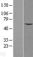 AGPAT7 (LPCAT4) Human Over-expression Lysates NM_153613. <br> Western blot validation of overexpression lysate (LS254531) using anti-DDK antibody. Left: Cell lysates from un-transfected HEK293T cells; Right: Cell lysates from HEK293T cells transfected with LPCAT4 (Myc-DDK-tagged) Human Tagged ORF Clone using transfection reagent.