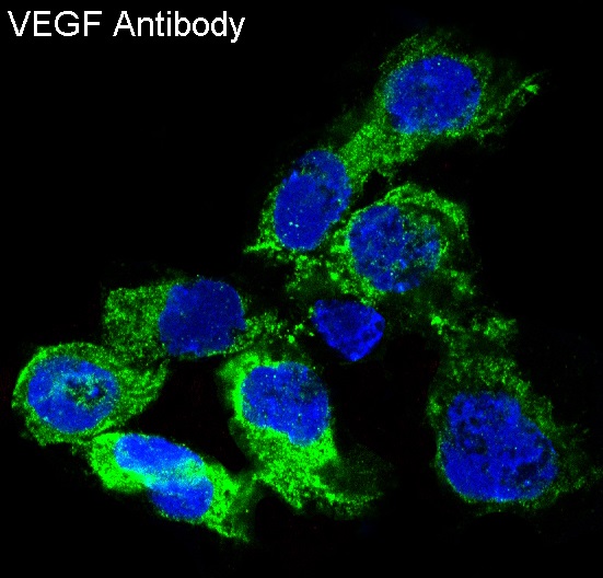 Immunofluorescent analysis of HUVEC cells, using VEGF Antibody.