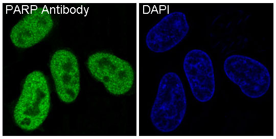 Immunofluorescent analysis of HeLa cells, using PARP Antibody.