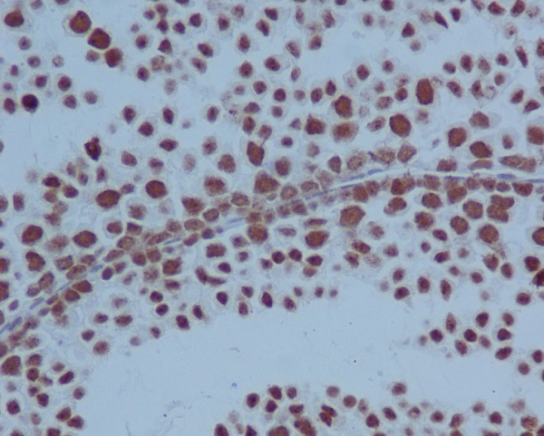 Immunohistochemical analysis of paraffin-embedded mouse testis, using PARP Antibody.