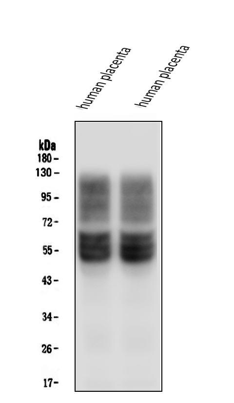 Western blot analysis of SLC2A1 using anti-SLC2A1 antibody (M00163-1).