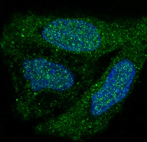 IF analysis of immunocytochemical section of HeLa cells using anti-p38 MAPK antibody (M00176-1) p38 MAPK was detected in immunocytochemical section. Enzyme antigen retrieval was performed using IHC enzyme antigen retrieval reagent (AR0022) for 15 mins. The tissue section was blocked with 10% goat serum. The tissue section was then incubated with 2μg/mL rabbit anti-p38 MAPK Antibody (M00176-1) overnight at 4 &deg