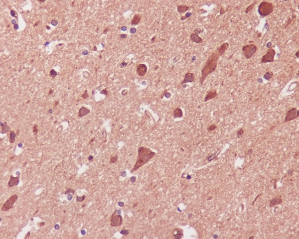 IHC analysis of p38 MAPK using anti-p38 MAPK antibody (M00176-1) on human brain. p38 MAPK was detected in paraffin-embedded section. Heat mediated antigen retrieval was performed in citrate buffer (pH6, epitope retrieval solution) for 20 mins. The tissue section was blocked with 10% goat serum. The tissue section was then incubated with 1ug/ml rabbit anti-p38 MAPK Antibody (M00176-1) overnight at 4°C. Biotinylated goat anti Rabbit IgG IgG antibody was used as secondary antibody and incubated for 30 minutes at 37°C. The tissue section was developed using Strepavidin-Biotin-Complex (SABC)(Catalog # SA1022) with DAB as the chromogen.