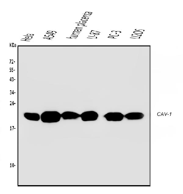 Western blot analysis of Caveolin-1/CAV1 using anti-Caveolin-1/CAV1 antibody (M00179-1).