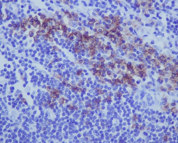 Immunohistochemical analysis of paraffin-embedded human tonsil, using CD38 Antibody.