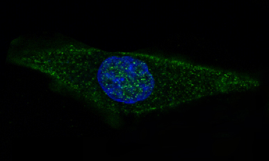 Immunofluorescent analysis of SH-SY5Y cells, using GFAP Antibody.