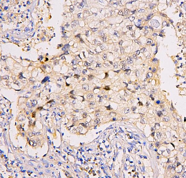 Recombinant Anti-Menin antibody [EPR3986] KO Tested (ab92443)