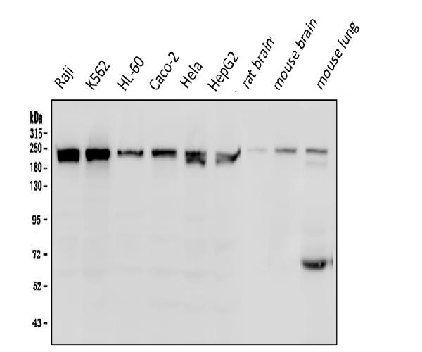 Recombinant Anti-Menin antibody [EPR3986] KO Tested (ab92443)