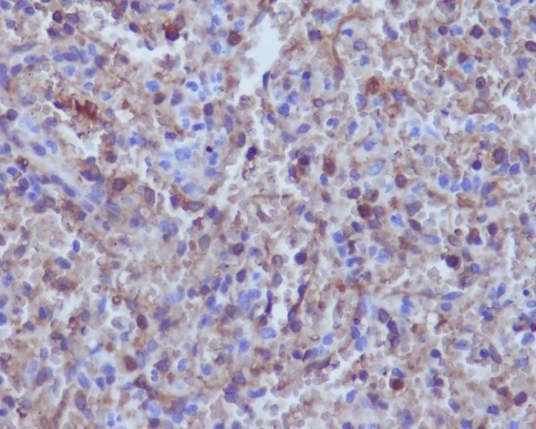 Immunohistochemical analysis of paraffin-embedded human spleen, using hemoglobin subunit alpha Antibody.