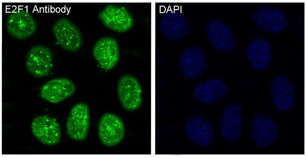 Immunofluorescent analysis of HeLa cells, using E2F1 Antibody.