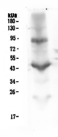 Western blot analysis of CD18 using anti-CD18 antibody (M00458-1). Electrophoresis was performed on a 5-20% SDS-PAGE gel at 70V (Stacking gel) / 90V (Resolving gel) for 2-3 hours. The sample well of each lane was loaded with 50ug of sample under reducing conditions. Lane 1: human placenta tissue lysate. After Electrophoresis, proteins were transferred to a Nitrocellulose membrane at 150mA for 50-90 minutes. Blocked the membrane with 5% Non-fat Milk/ TBS for 1.5 hour at RT. The membrane was incubated with mouse anti-CD18 antigen affinity purified monoclonal antibody (Catalog # M00458-1) at 0.5 μg/mL overnight at 4°C, then washed with TBS-0.1%Tween 3 times with 5 minutes each and probed with a goat anti-mouse IgG-HRP secondary antibody at a dilution of 1:10000 for 1.5 hour at RT. The signal is developed using an Enhanced Chemiluminescent detection (ECL) kit (Catalog # EK1001) with Tanon 5200 system.