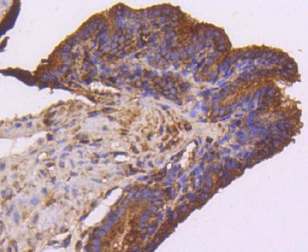 Immunohistochemical analysis of paraffin-embedded mouse placenta tissue using anti-VEGF Receptor 1 antibody. The section was pre-treated using heat mediated antigen retrieval with Tris-EDTA buffer (pH 9.0) for 20 minutes.The tissues were blocked in 5% BSA for 30 minutes at room temperature, washed with ddH2O and PBS, and then probed with the primary antibody (1/50) for 30 minutes at room temperature. The detection was performed using an HRP conjugated compact polymer system. DAB was used as the chromogen. Tissues were counterstained with hematoxylin and mounted with DPX.