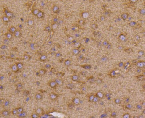 Immunohistochemical analysis of paraffin-embedded mouse brain tissue using anti-VEGF Receptor 1 antibody. The section was pre-treated using heat mediated antigen retrieval with Tris-EDTA buffer (pH 9.0) for 20 minutes.The tissues were blocked in 5% BSA for 30 minutes at room temperature, washed with ddH2O and PBS, and then probed with the primary antibody (1/50) for 30 minutes at room temperature. The detection was performed using an HRP conjugated compact polymer system. DAB was used as the chromogen. Tissues were counterstained with hematoxylin and mounted with DPX.